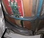 NEW MAGNET BODY COIL 1.5T